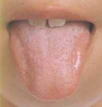 正常な舌苔